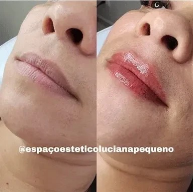 Estética Luciana Pequeno